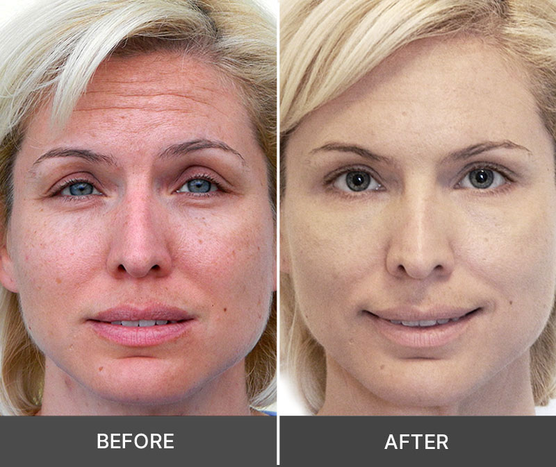 Skin comparison image displayed on the merchant's sales page; results not independently verified